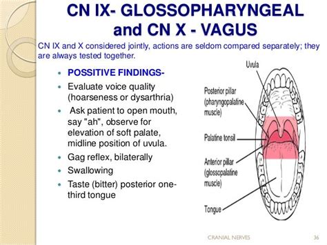 how to test rise of soft palate|soft palate uvula.